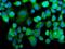 Mitogen-Activated Protein Kinase Kinase Kinase 2 antibody, A02354-1, Boster Biological Technology, Immunofluorescence image 