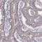 G Protein-Coupled Receptor Kinase 1 antibody, NBP2-55732, Novus Biologicals, Immunohistochemistry frozen image 