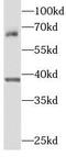 Septin 9 antibody, FNab07729, FineTest, Western Blot image 
