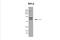 Ribosomal Protein L5 antibody, NBP1-57126, Novus Biologicals, Western Blot image 