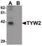 TRNA Methyltransferase 12 Homolog antibody, PA5-21153, Invitrogen Antibodies, Western Blot image 