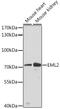 EMAP Like 2 antibody, 19-417, ProSci, Western Blot image 