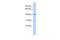 Epithelial Stromal Interaction 1 antibody, PA5-43176, Invitrogen Antibodies, Western Blot image 