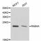 RAB4A, Member RAS Oncogene Family antibody, STJ112987, St John