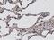 Histone Deacetylase 6 antibody, M00595-1, Boster Biological Technology, Immunohistochemistry paraffin image 