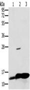 NADH:Ubiquinone Oxidoreductase Subunit S5 antibody, CSB-PA448660, Cusabio, Western Blot image 