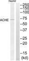 Acetylcholinesterase antibody, abx014143, Abbexa, Western Blot image 
