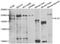 Alsin Rho Guanine Nucleotide Exchange Factor ALS2 antibody, A7125, ABclonal Technology, Western Blot image 