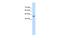 Beta-Ureidopropionase 1 antibody, A08024, Boster Biological Technology, Western Blot image 