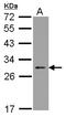 Nucleolar Protein 3 antibody, LS-C155359, Lifespan Biosciences, Western Blot image 