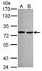 Acyl-CoA Synthetase Long Chain Family Member 3 antibody, NBP2-15252, Novus Biologicals, Western Blot image 