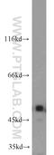 Integrin Linked Kinase antibody, 12955-1-AP, Proteintech Group, Western Blot image 
