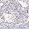 NUT Midline Carcinoma Family Member 1 antibody, NBP1-84176, Novus Biologicals, Immunohistochemistry frozen image 