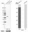 N-Acylsphingosine Amidohydrolase 1 antibody, NBP1-89296, Novus Biologicals, Western Blot image 