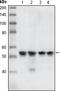 Checkpoint Kinase 1 antibody, STJ97955, St John
