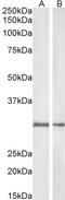 NAD(P)H Quinone Dehydrogenase 1 antibody, LS-B11145, Lifespan Biosciences, Western Blot image 