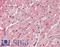 Fatty Acid Binding Protein 4 antibody, LS-B11196, Lifespan Biosciences, Immunohistochemistry paraffin image 