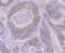 Ribonucleotide Reductase Catalytic Subunit M1 antibody, NBP2-75650, Novus Biologicals, Immunohistochemistry paraffin image 