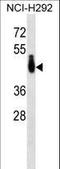 Poly(A) Binding Protein Cytoplasmic 4 Like antibody, LS-C163333, Lifespan Biosciences, Western Blot image 