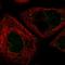 E3 ubiquitin-protein ligase RNF6 antibody, HPA040048, Atlas Antibodies, Immunofluorescence image 