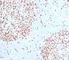 DNA Topoisomerase II Alpha antibody, V7245SAF-100UG, NSJ Bioreagents, Western Blot image 