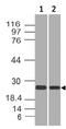 RAP2A, Member Of RAS Oncogene Family antibody, A03547, Boster Biological Technology, Western Blot image 