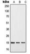 Matrix Metallopeptidase 1 antibody, LS-C352517, Lifespan Biosciences, Western Blot image 