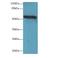 Transmembrane Protein 161A antibody, LS-C376825, Lifespan Biosciences, Western Blot image 