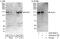 DNA polymerase alpha catalytic subunit antibody, A302-850A, Bethyl Labs, Western Blot image 