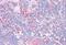 Galectin 9 antibody, MBS247085, MyBioSource, Immunohistochemistry paraffin image 