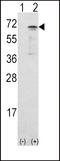 Calcium/Calmodulin Dependent Protein Kinase Kinase 1 antibody, 63-191, ProSci, Western Blot image 