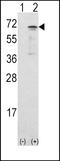 Calcium/calmodulin-dependent protein kinase kinase 1 antibody, 63-191, ProSci, Western Blot image 