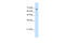 Transmembrane 9 Superfamily Member 1 antibody, 31-344, ProSci, Western Blot image 