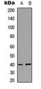 Protein Kinase CAMP-Activated Catalytic Subunit Gamma antibody, orb304518, Biorbyt, Western Blot image 