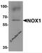 NADPH Oxidase 1 antibody, 7921, ProSci, Western Blot image 