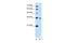 Solute Carrier Family 38 Member 3 antibody, A06782-1, Boster Biological Technology, Western Blot image 
