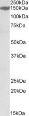 Microtubule Associated Serine/Threonine Kinase 3 antibody, PA5-37930, Invitrogen Antibodies, Western Blot image 