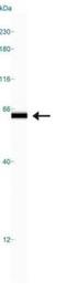 Keratin 5 antibody, NB110-56916, Novus Biologicals, Western Blot image 