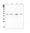 Complement Factor Properdin antibody, A00852-2, Boster Biological Technology, Western Blot image 