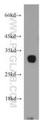 Collectrin, Amino Acid Transport Regulator antibody, 19207-1-AP, Proteintech Group, Western Blot image 