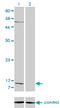 Pro-Platelet Basic Protein antibody, LS-C197961, Lifespan Biosciences, Western Blot image 