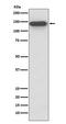 Structural Maintenance Of Chromosomes 3 antibody, M01930, Boster Biological Technology, Western Blot image 