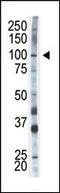 Hexokinase 1 antibody, MBS9204225, MyBioSource, Western Blot image 