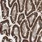 Zinc Finger Protein 354C antibody, NBP1-81352, Novus Biologicals, Immunohistochemistry frozen image 