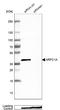 Actin Related Protein 2/3 Complex Subunit 1A antibody, NBP1-88851, Novus Biologicals, Western Blot image 