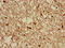 Transmembrane Protein 161B antibody, LS-C396686, Lifespan Biosciences, Immunohistochemistry paraffin image 