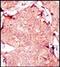 Cellular myelocytomatosis oncogene antibody, orb256348, Biorbyt, Immunohistochemistry paraffin image 