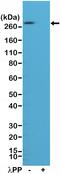 Acetyl-CoA carboxylase antibody, MA5-27974, Invitrogen Antibodies, Western Blot image 