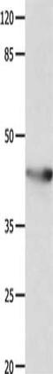 Potassium Voltage-Gated Channel Subfamily A Member 5 antibody, orb519109, Biorbyt, Western Blot image 