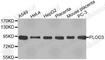 Procollagen-Lysine,2-Oxoglutarate 5-Dioxygenase 3 antibody, A2285, ABclonal Technology, Western Blot image 